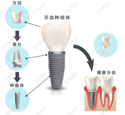 NֲʿITI͵BEGOą^eHǃr߀......